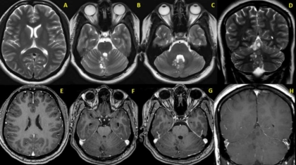 Case of the Month November 2020