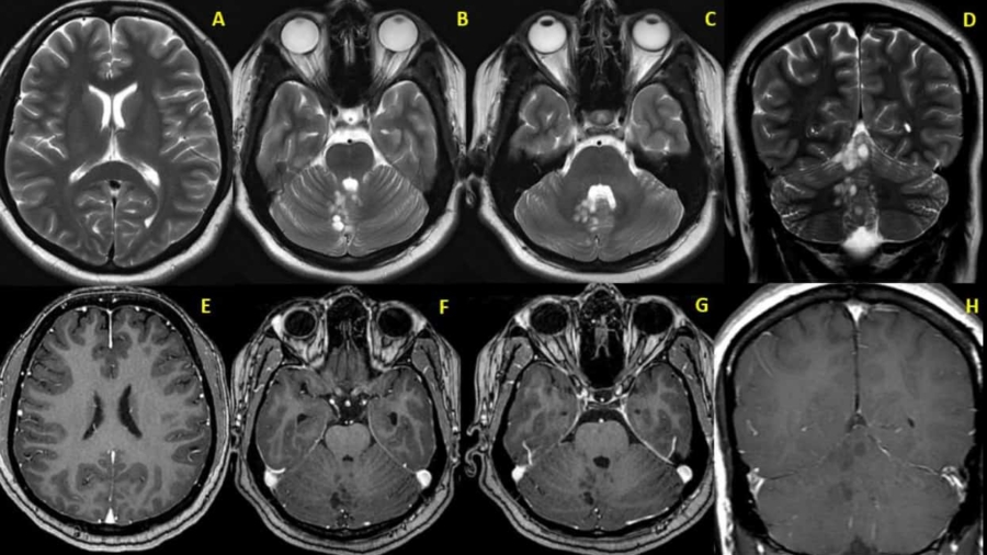 Case of the Month November 2020