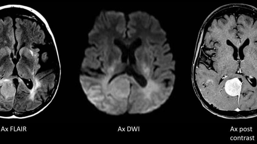 Case of the Month January 2021