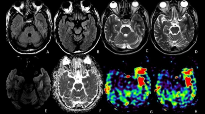 Case of the Month October 2020