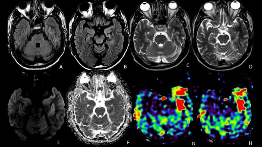 Case of the Month October 2020