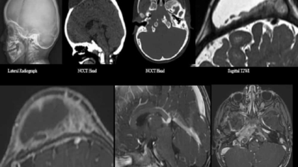 February Image updated