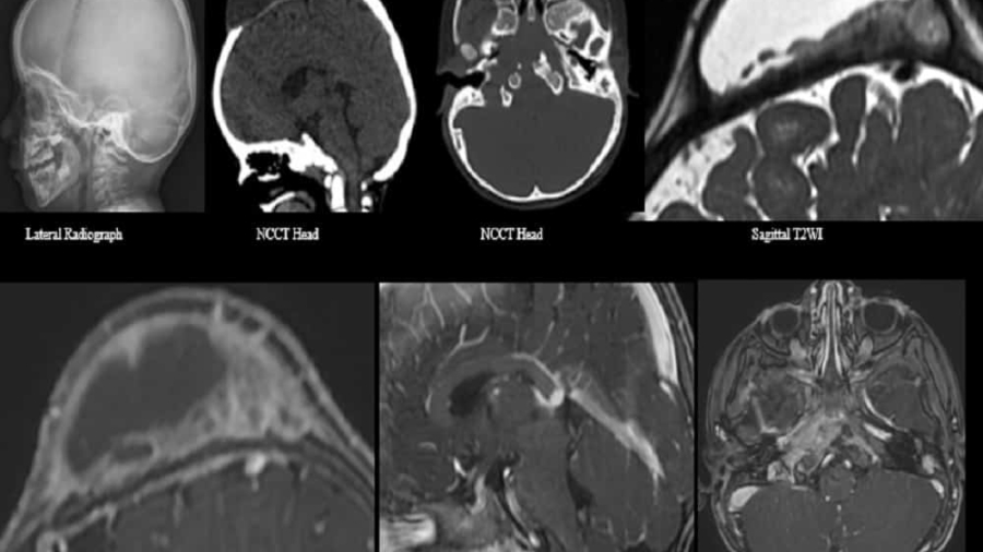 February Image updated