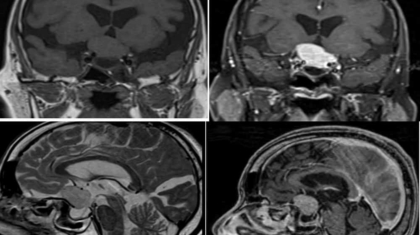 featured img Nov 2021