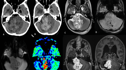 Featuredimgnov22-min