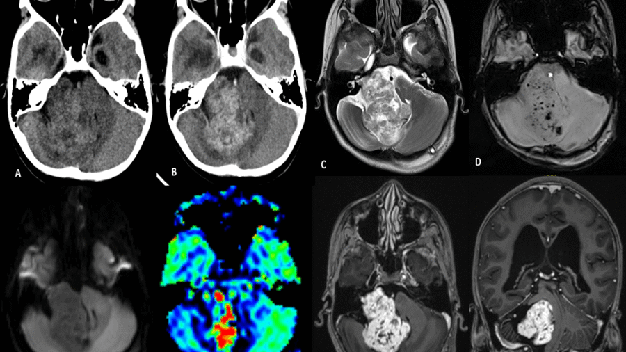 Featuredimgnov22-min