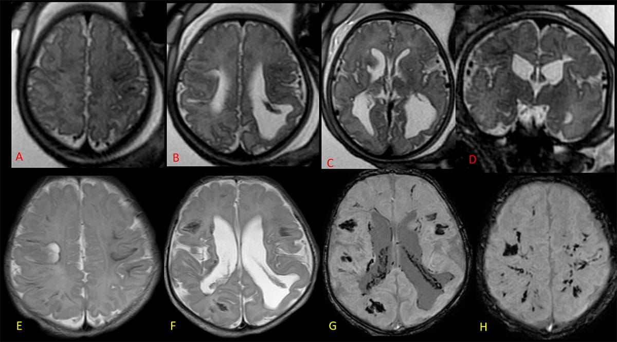 Case of the month - March 2025