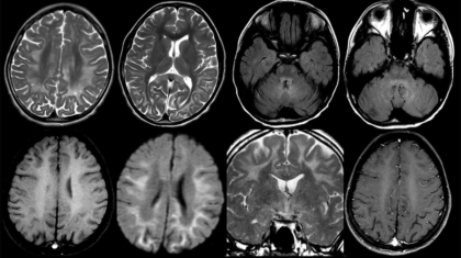 Case of the month - April 2025