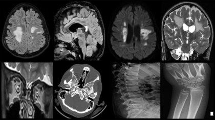 case-of-the-month-may-2025