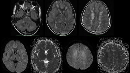 case-of-the-month-june-2025