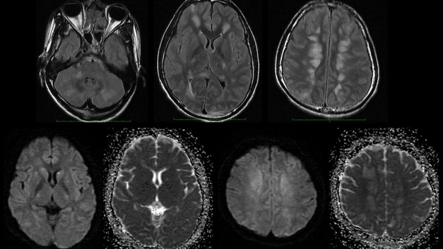case-of-the-month-june-2025