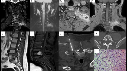 case-of-the-month-august-2025