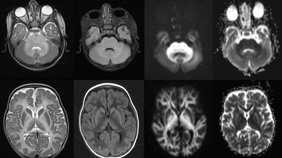 case-of-the-month-september-2025