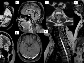 case-of-the-month-october-2025