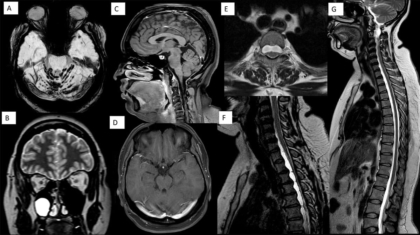 case-of-the-month-october-2025