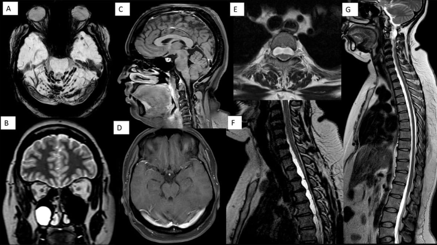 case-of-the-month-october-2025