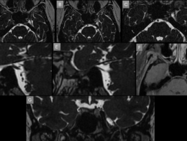 case-of-the-month-november-2025