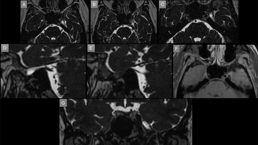 case-of-the-month-november-2025