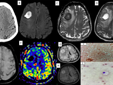 case-of-the-month-december-2025-2