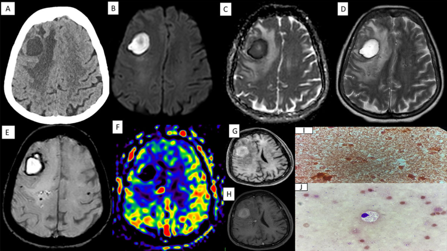 case-of-the-month-december-2025-2