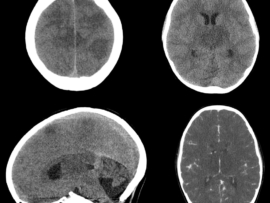 case-of-the-month-december-2025