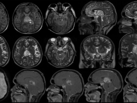 case-of-the-month-january-2026