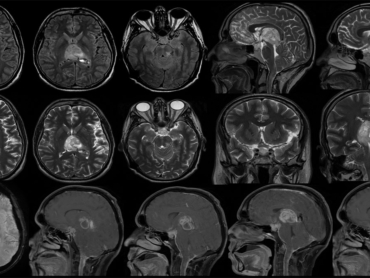 case-of-the-month-january-2026