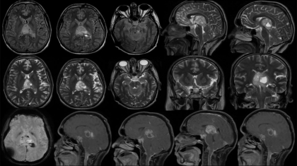 case-of-the-month-january-2026