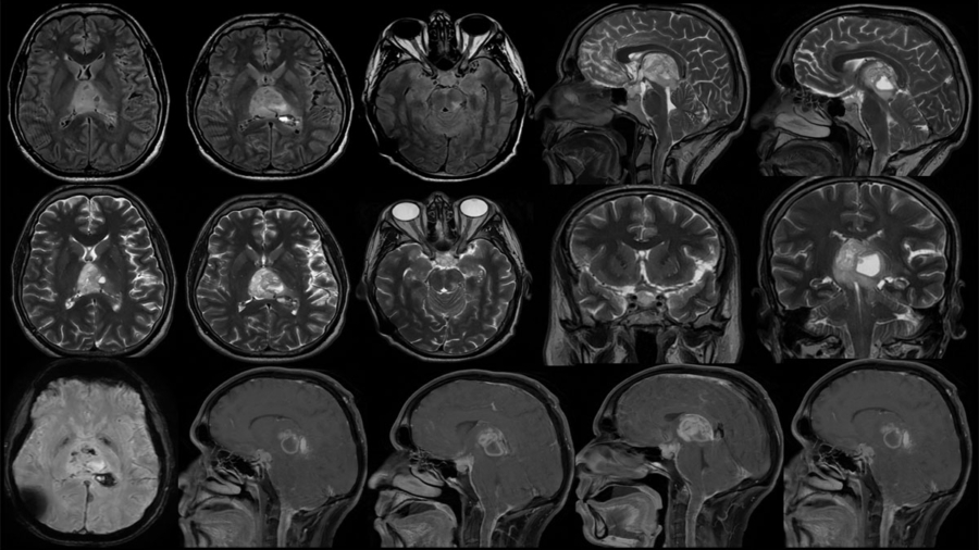 case-of-the-month-january-2026