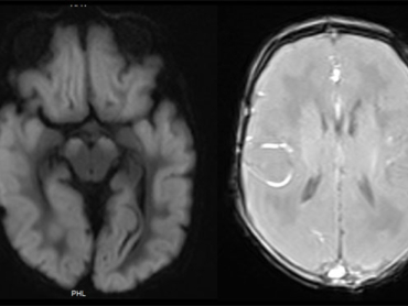 case-of-the-month-february-2026