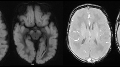 case-of-the-month-february-2026