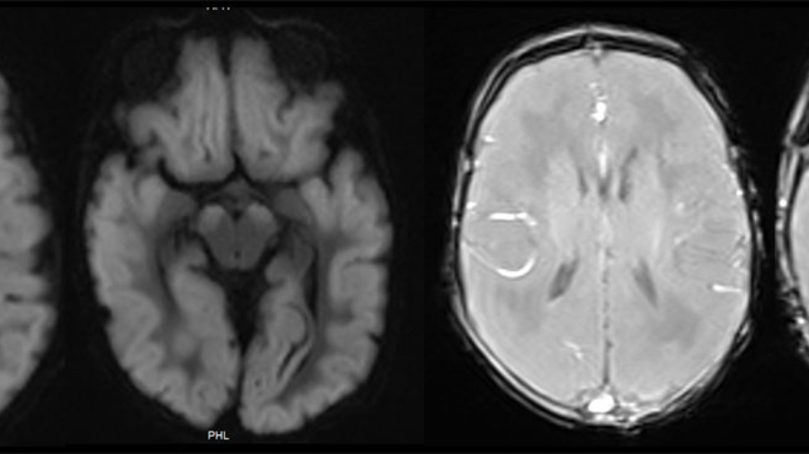 case-of-the-month-february-2026
