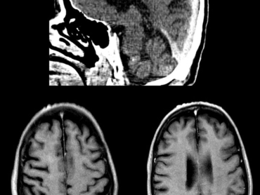 case-of-the-month-march-2026-5
