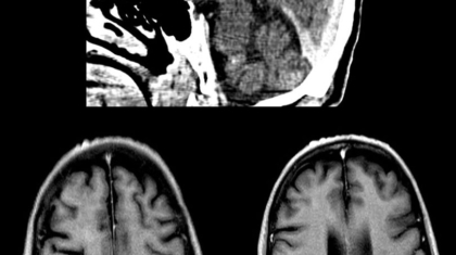 case-of-the-month-march-2026-5