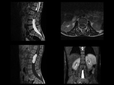 case-of-the-month-april-2026