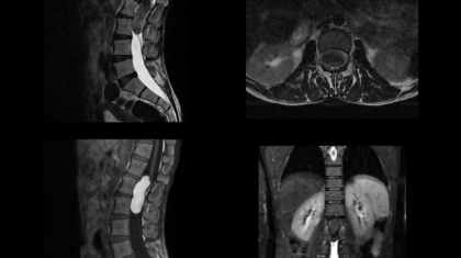 case-of-the-month-april-2026